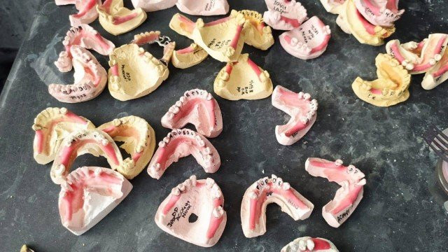 Polícia interdita laboratório que revendia protéses dentárias compradas de cemitérios como se fossem novas