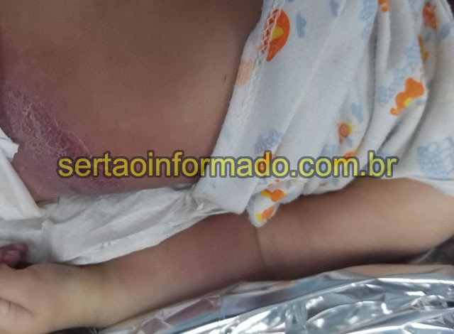 Bebê de 4 meses morre misteriosamente na cidade de Sousa