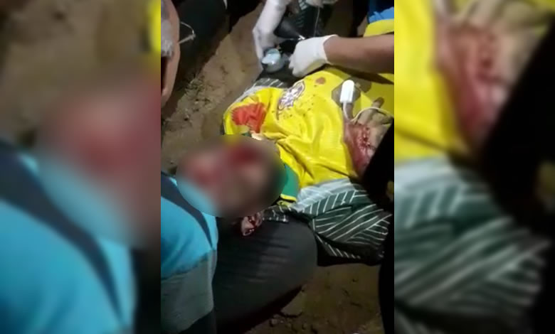 VÍDEO: Grave acidente de trânsito deixa populares feridos na zona rural de São Francisco, região de Sousa