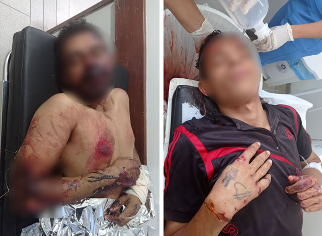 Dupla fica gravemente ferida após tentativa de assalto na PB-383, entre Sousa e Lastro