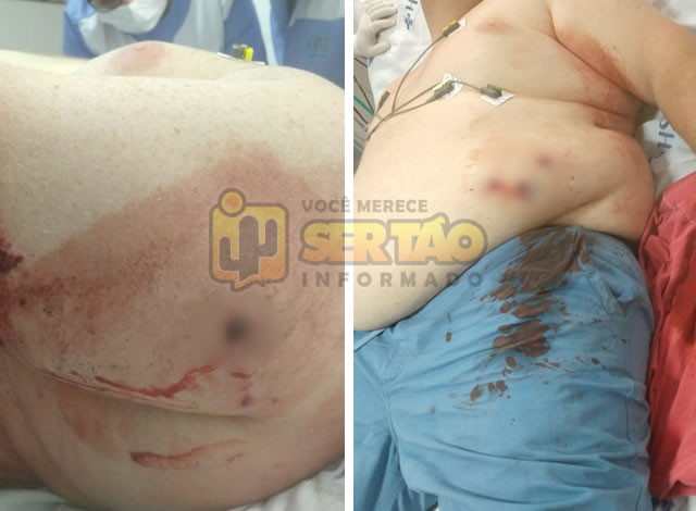 Homem dá entrada em hospital da cidade de Sousa alvejado com tiros de arma de fogo