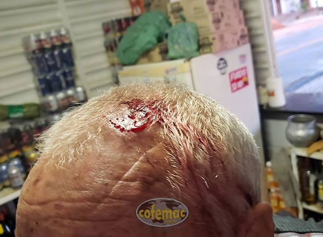 Comerciante é agredido durante assalto em seu estabelecimento na cidade de Uiraúna