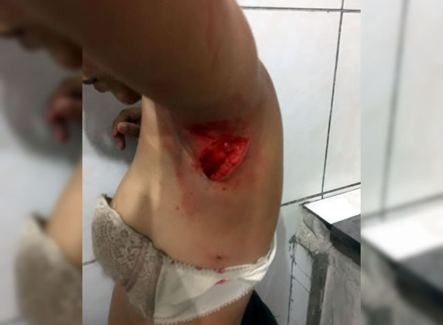Em Coremas: Após abraçar e beijar, adolescente de 12 anos aplica 5 golpes de punhal em colega de escola