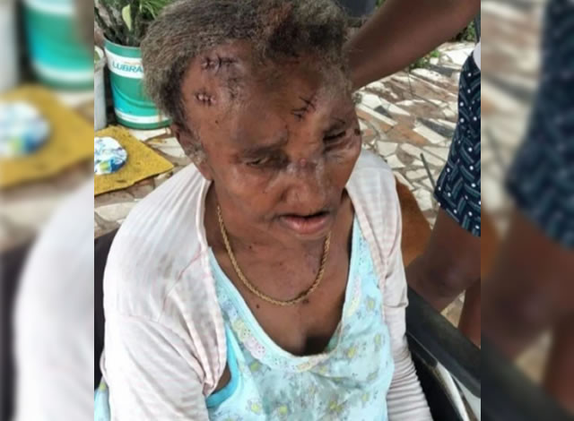 Homem é preso após agredir a sua própria mãe com pedradas em Coremas
