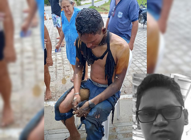 Jovem que colocou fogo no próprio corpo em Pombal, não resiste e morre