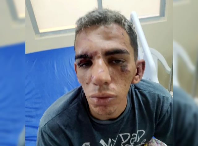 GTE prende ex-presidiário acusado de roubar moto na cidade de Cajazeiras
