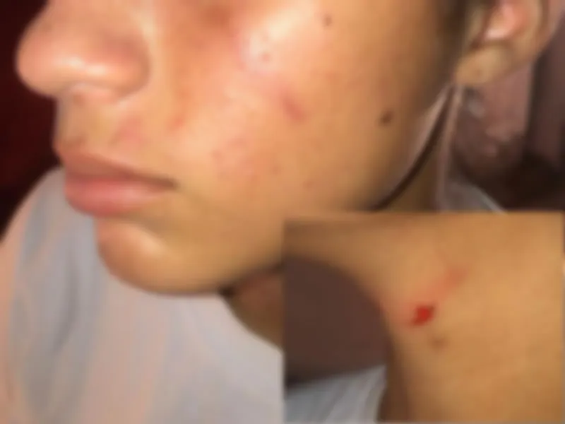 Aluna tenta ferir colega com faca dentro de escola em Aparecida; família denuncia negligência